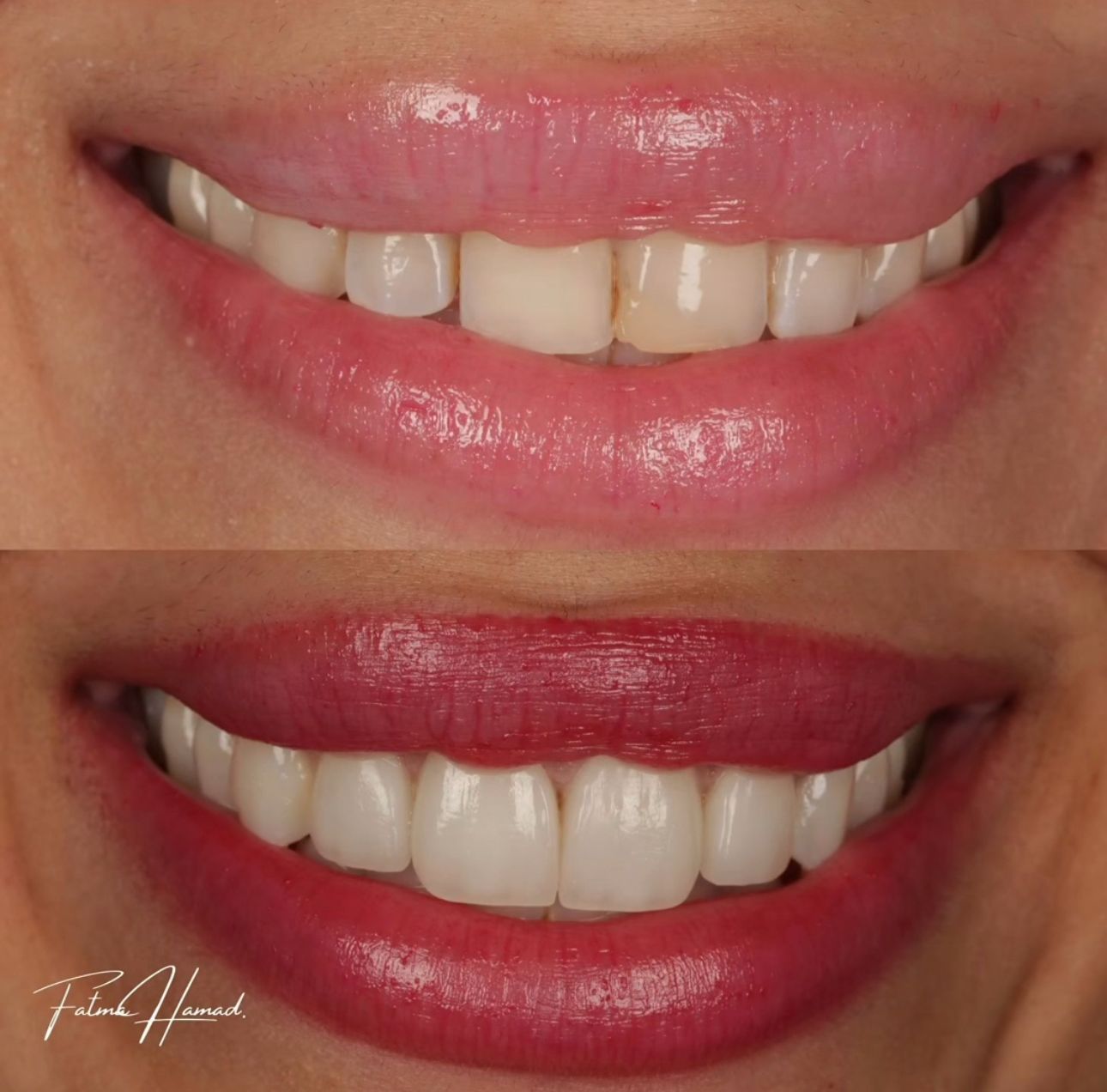 نتيجة العلاج 1