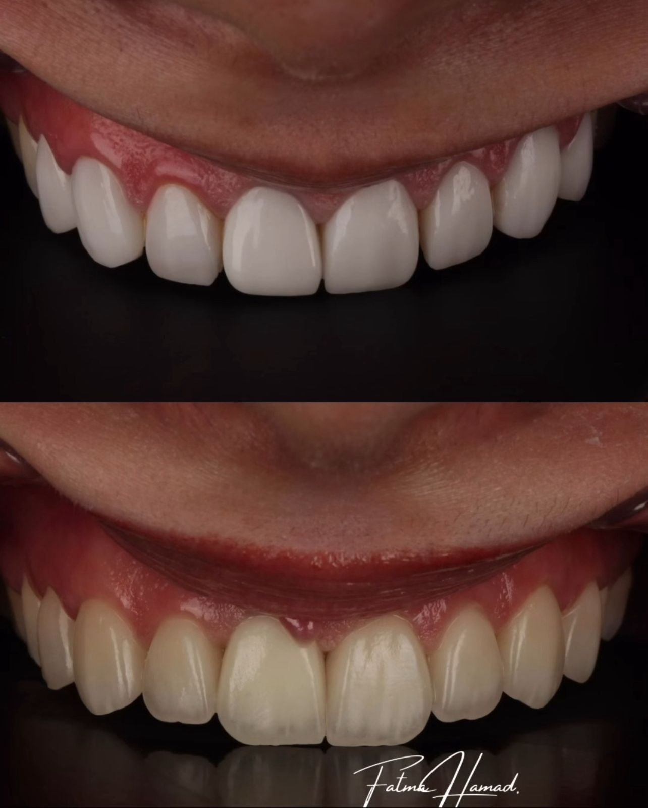 نتيجة العلاج 2