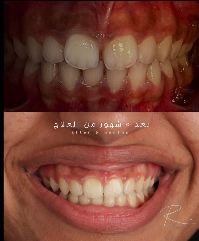 نتيجة العلاج 3